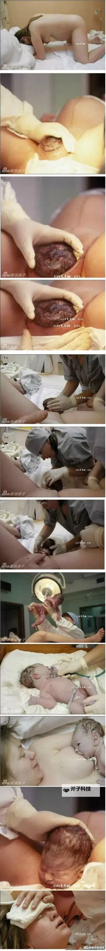 真实记录：孕妇分娩视频过程全景揭秘图1